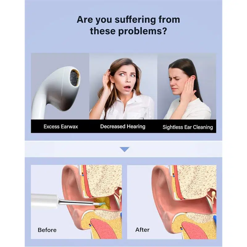 Bebırd T5 3Mp Kamera 3.5Mm Lens Şarjlı Wıfı Görüntülü Kulak Temizleyici Beyaz Renk